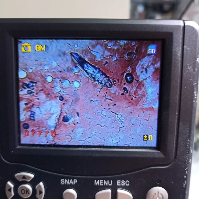 Demodikozis Hastalığının Etkeni Demodex Canis